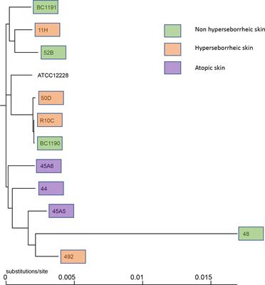 Staphylococcus epidermidis isolates from atopic or healthy skin have opposite effect on skin cells: potential implication of the AHR pathway modulation